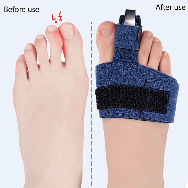 1 Stuks Teen Corrector Teenbre - Ankle Brace Sock recensie en prijs
